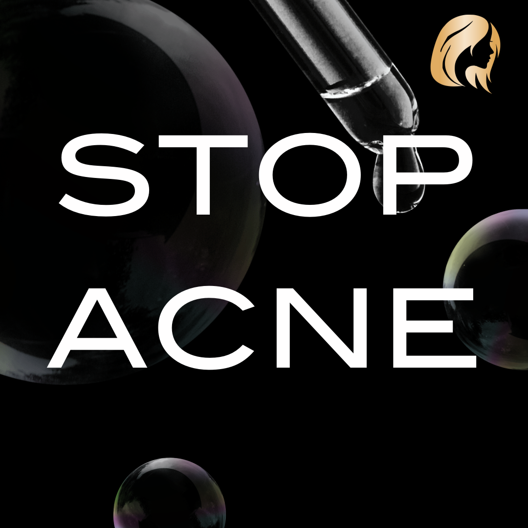 Stop Acne